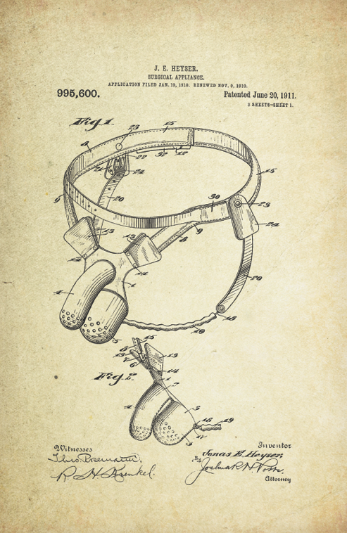 Chastity Belt Patent Poster (1911, J.E. Heyser)